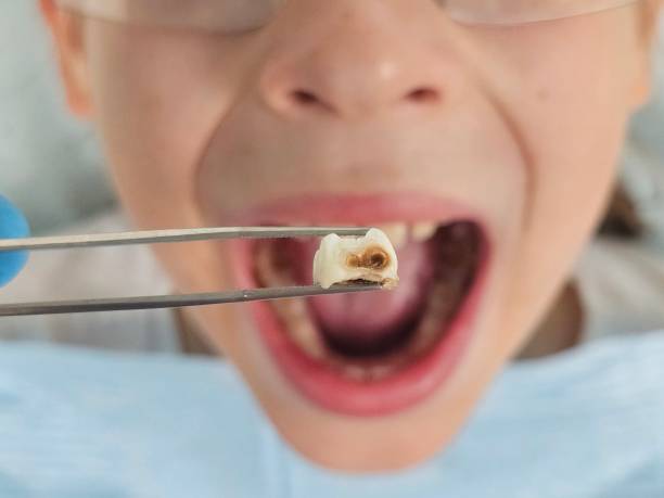 Professional Emergency Dental Service in NJ